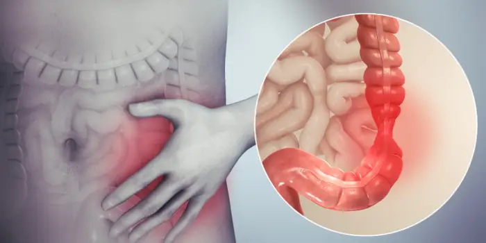 irritable bowel syndrome (ibs) treatment in mumbai