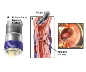 gastric disorders treatment in mumbai