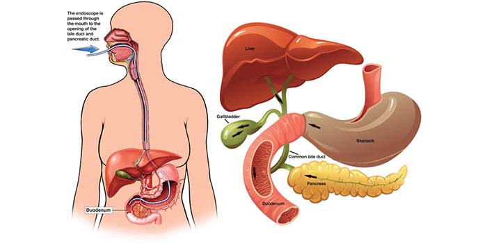 endoscopic retrograde cholangio-pancreatography (ercp) in mumbai